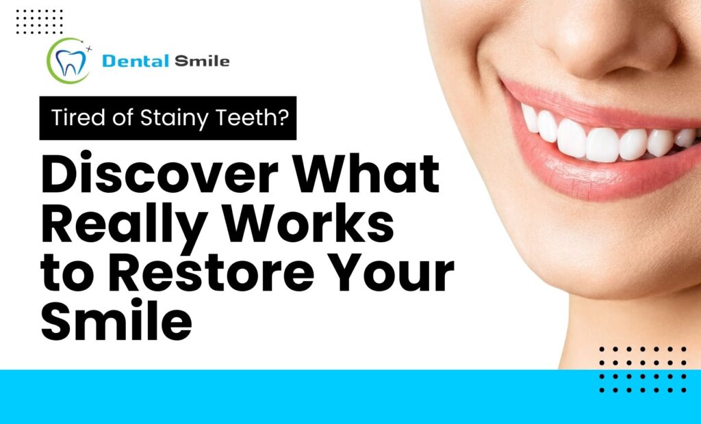 Tired of Stainy Teeth? Discover What Really Works to Restore Your Smile 