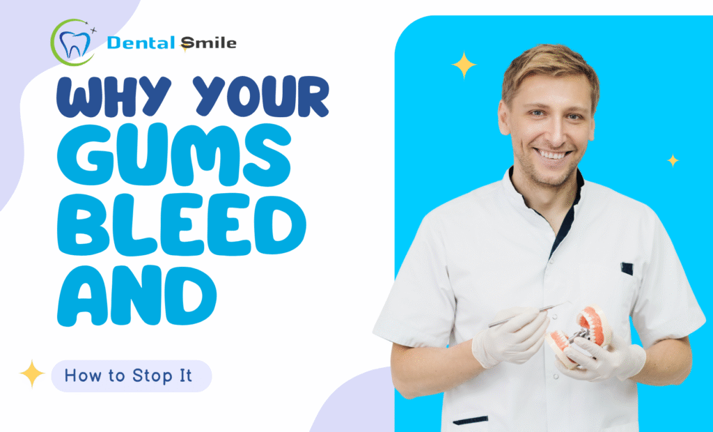Why Your Gums Bleed and How to Stop It 