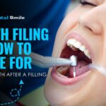 teeth filling