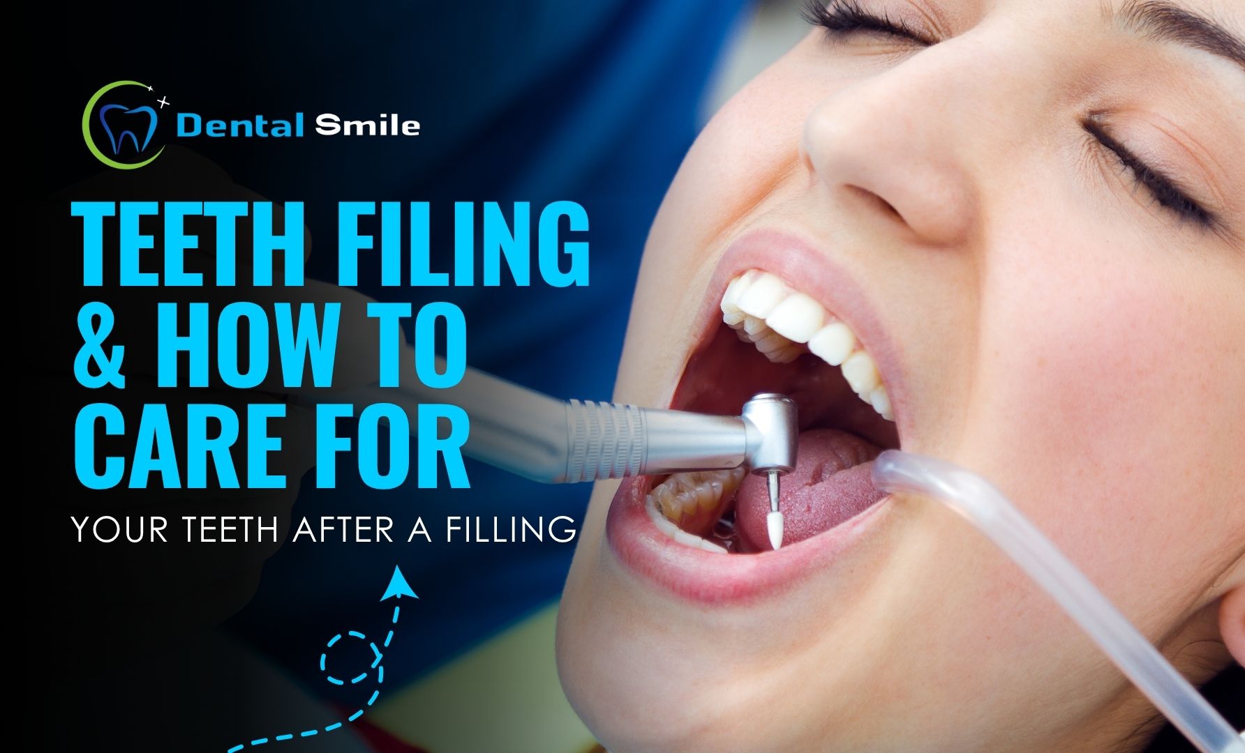 teeth filling