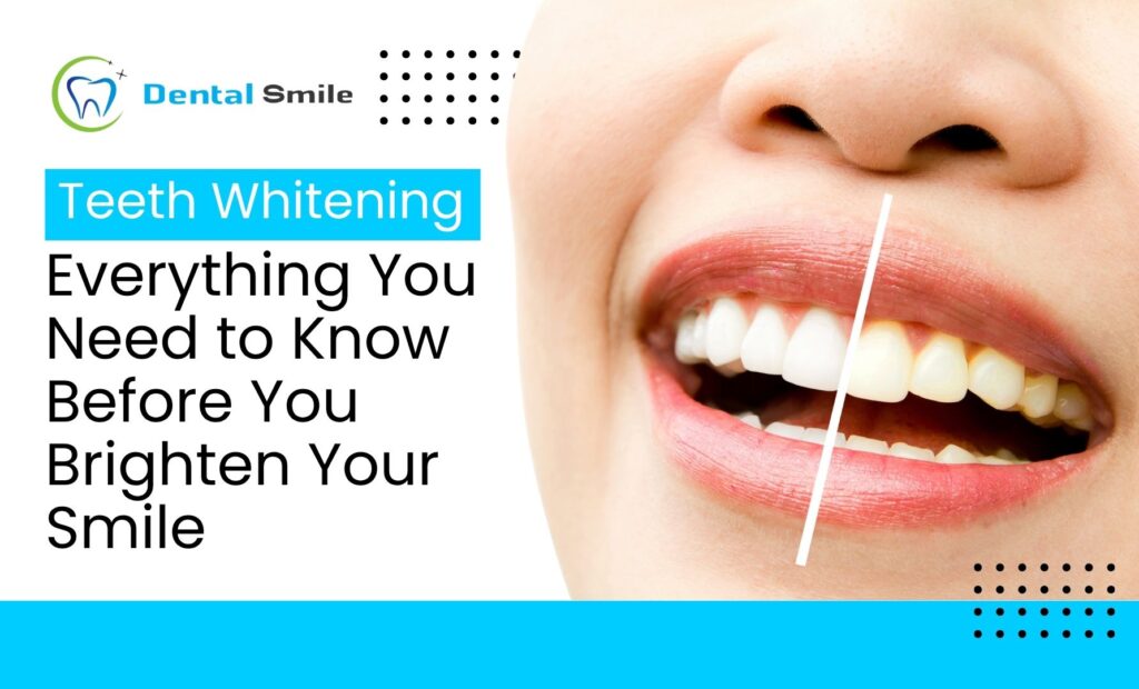 Teeth Whitening