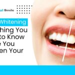 Teeth Whitening