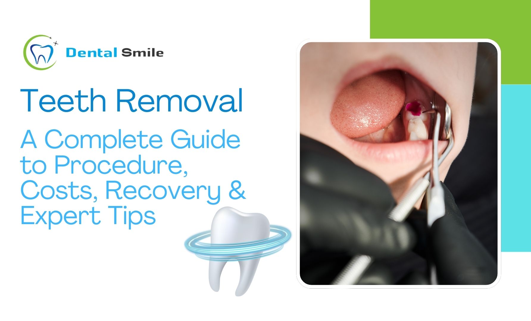 Teeth Removal
