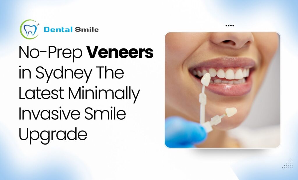 Veneers for Teeth
