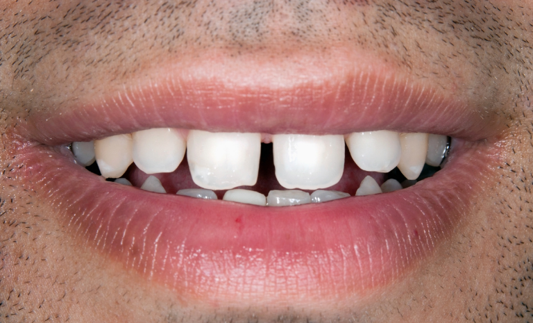 preventive-dentistry (2) preventive-dentistry