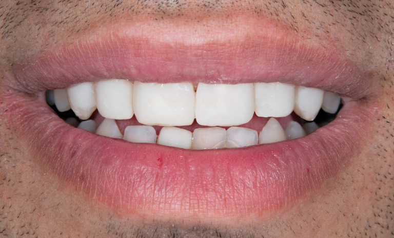 preventive-dentistry preventive-dentistry