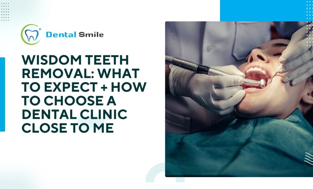 Wisdom Teeth Removal