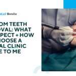 Wisdom Teeth Removal