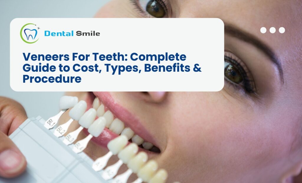 Veneers For Teeth