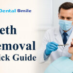 Teeth Removal