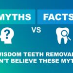 Wisdom Teeth Removal